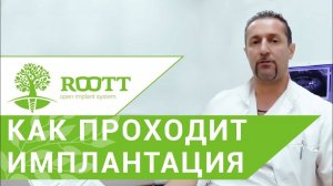 Установка импланта зуба. Этапы установки импланта зуба. ROOTT