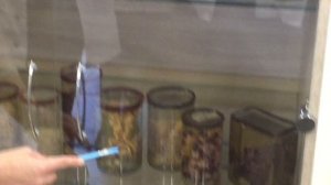 Патологическая анатомия. Макропрепараты, 9 ГКБ