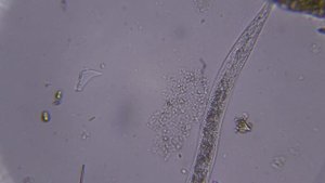 Кто ты, Нематода? КРУГЛЫЕ ЧЕРВИ И ИНТЕРЕСНЫЕ ФАКТЫ О НЕМАТОДАХ | Нематоды под микроскопом