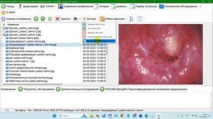 2024-09-12-_150215-Окно Обследования, копирование фото в буфер и импорт в Word, 2 пути, Удалить коне