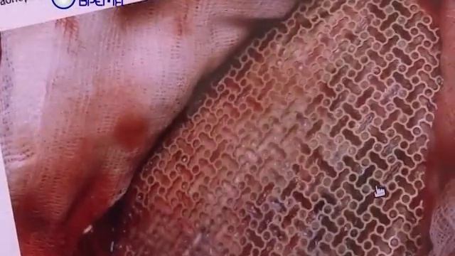 Нейрохирург Тобольск смотреть онлайн