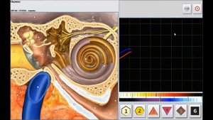 NLS Metanron Hanter Сканирование