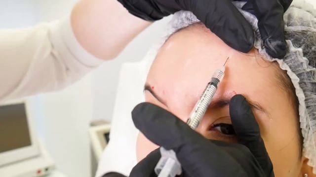 Коррекция мимических морщин | FULL FACE | Ксеомин смотреть онлайн