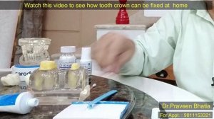 How to fix tooth crown at home in case of emergency-Dr.Praveen Bhatia