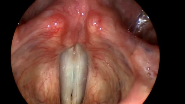 Whistle Register Свистковый регистр смотреть онлайн