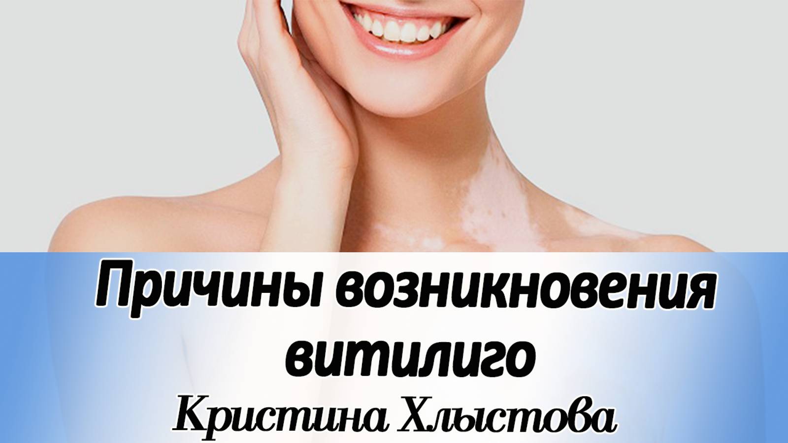 Причины возникновения ВИТИЛИГО. Чем можно помочь? | Кристина Хлыстова #витилиго #doterra #raw