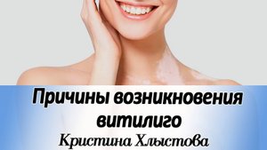Причины возникновения ВИТИЛИГО. Чем можно помочь? | Кристина Хлыстова #витилиго #doterra #raw