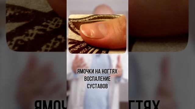 Проверь свои ногти! Диагностика по ногтям #shorts