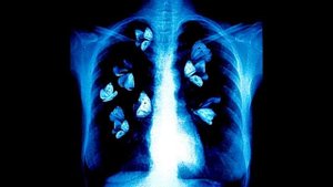 ★{10+}★ JERK X HOODTRAP LOOP KIT - 02:52 (PROD.3V3NPOTS)