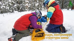 Спасатели - травма ноги
