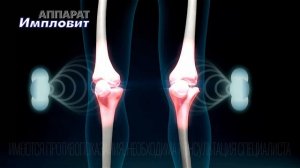 Физиотерапевтический Аппарат - Импловит