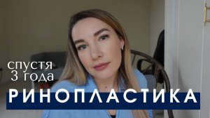 РИНОПЛАСТИКА |Кому точно не стоит делать операцию. Отзыв спустя 3 года после ринопластики в Турции