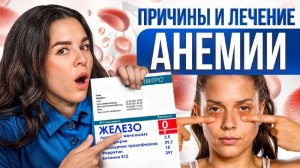 Как понять, что у тебя железодефицит? ТОП 10 важных продуктов в рационе при анемии