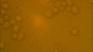 Yeast under microscope(100X objective, eyepiece 1.3mp camera)