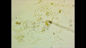 Pond Water Protists Under the Microscope - Motile Algae