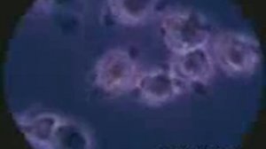 Правда о ВИЧ инфекции его НЕТ !