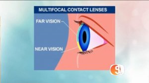 TIP: Multifocal Contact Lenses