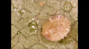 A CLOSER LOOK AT SCALE ON MY PLUMERIA TREE UNDER THE MICROSCOPE