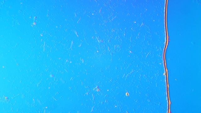 Бактерии в воде из водохранилища. смотреть онлайн