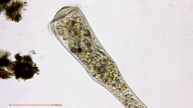 Elastic Stentor (microscopy) смотреть онлайн