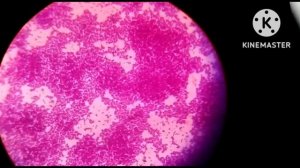 Staphylococcus aureus (gram positive bacteria) under the microscope 100x... are seen!!