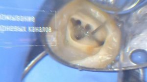 Работа с микроскопом, доктор Гололобов Илья