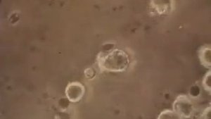 3 Амебоидное движение лимфоцитов