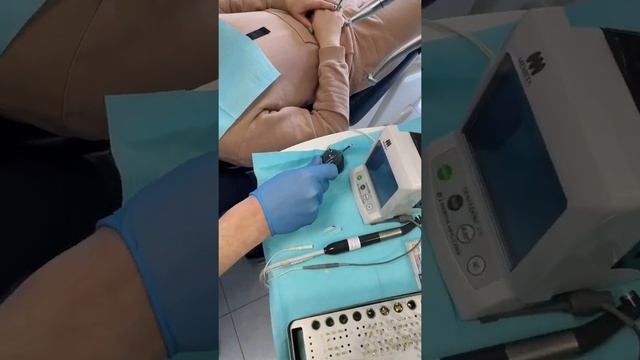 Как выглядит пломбирование  каналов зуба? Заглянули на прием к терапевту- эндодонтисту!