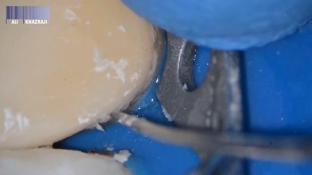 NIKON Z50 mirrorless UNDER ZUMAX OMS 2380...DENTAL REVIEW смотреть онлайн