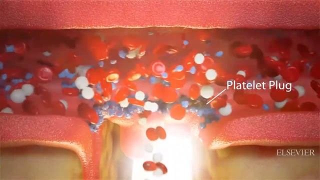 Platelets And Clot Formation