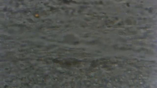 Mikroskop, śluz ze skóry, x400 смотреть онлайн