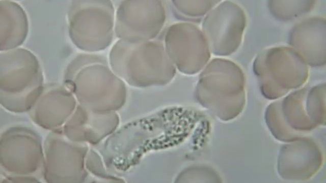 Гемосканирование. Часть вторая. смотреть онлайн
