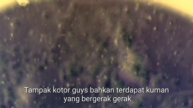 ZOOM 1000x Gigi Berlubang II Tooth Under Microscope смотреть онлайн