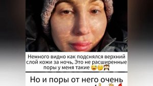 Желтый пилинг