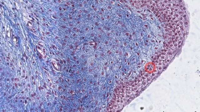 Переходный эпителий смотреть онлайн