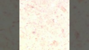 5 random things under a 1600x microscope