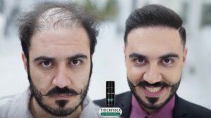 Смотрите, что делают с мужчиной парикмахер и загуститель волос😇