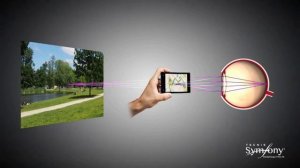 Tecnis Symfony EDoF ИОЛ с расширенной глубиной фокуса. Обзор и сравнение с мультифокальными линзами