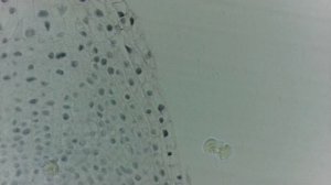 Митоз в корешке лука Mitosis in a little root of an onions