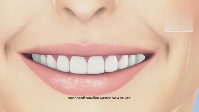 Профессиональное отбеливание ZOOM! 4 в Стоматологии на мира 5