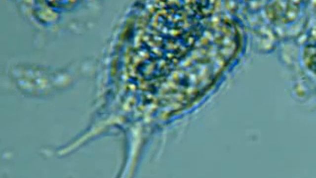 Bresser LCD Microscope - #3 смотреть онлайн