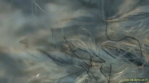 Sock under microscope - Inskam 315