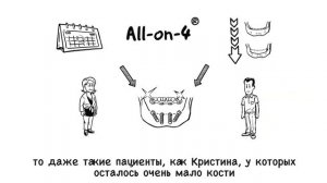 ΠΠΌΠΏΠ»Π°Π½ΡΠ°ΡΠΈΡ Π·ΡΠ±ΠΎΠ² All on 4 ΠΠ°Π»ΠΈΠ½ΠΈΠ½Π³ΡΠ°Π΄