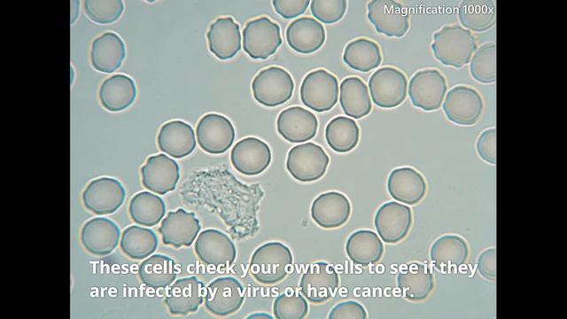 White Blood Cells Crawling Under The Microscope - 1000x magnification ...