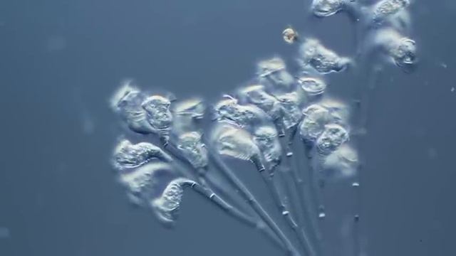 Epistylis im Differenziellen Interferenzkontrast DIK DIC (2) смотреть онлайн