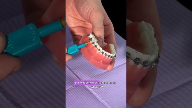 Как чистить зубы с брекетами?
