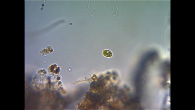 Цианобактерия под микроскопом under microscope
