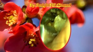 biggest ear wax removal || Cleaning ear