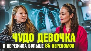 МЕНЯ В ДЕТСТВЕ ПРЕДЛАГАЛИ УСЫПИТЬ, НО ПРОИЗОШЛО ЧУДО!