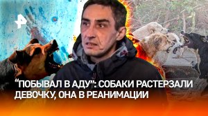 Собаки напали на 12-летнюю девочку в Якутии, ребенок в реанимации, родители – "в аду"